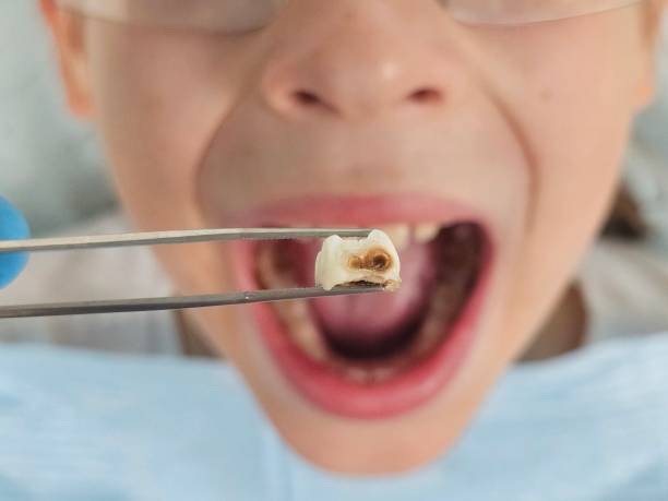 Best Weekend Emergency Dentist in Wallace, ID